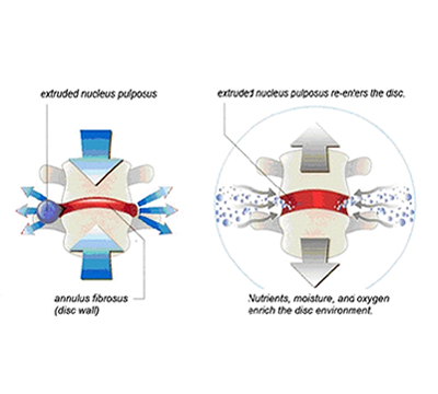 ELDOAs are postural self-normalizing techniques designed for widening the space within a chosen articulation. This is accomplished...